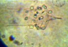 Organismos planctónicos vistos al microscopio