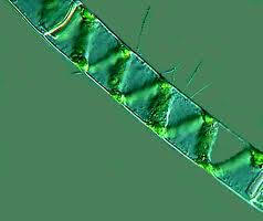 Alga spirogyra al microscopio, donde se puede observar su típica disposición de filamentos en zig-zag