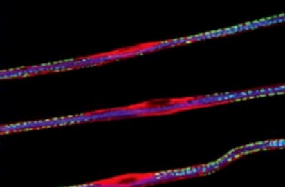 Las fibras nerviosas en la imagen (azul/púrpura) se encuentran rodeadas por las células de Schwann (rojo), aislándolos de la actividad eléctrica nerviosa de las fibras vecinas. Los diferentes colores se deben a la aplicación de anticuerpos asociados a distintos fluorocromos que identifican nuevos complejos proteicos. La alteración de estos complejos proteicos induce una enfermedad hereditaria que implica una pérdida de la masa muscular.
