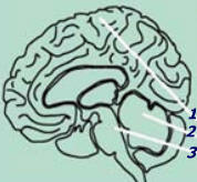 Vista sagital mostrando la división entre hemisferios cerebrales y tronco del encéfalo. Extendiéndose dorsalmente al tronco del encéfalo, se puede observar el cerebelo. 1-Hemisferio cerebral, 2-Tronco de encéfalo, 3-Cerebelo
