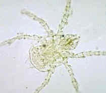 Imagen de un ácaro visto al microscopio