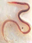 La ascaris lumbricoides (la común lombriz intestinal), es un nemátodo parásito del hombre y otros animales